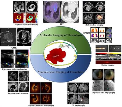 Molecular Imaging and Non-molecular Imaging of Atherosclerotic Plaque Thrombosis